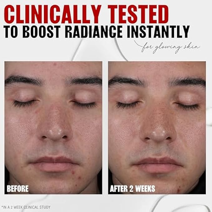 THAYERS 2% AHA EXFOLIATING TONER WITH GLYCOLIC ACID, LACTIC ACID AND WITCH HAZEL, SMOOTHING AND PORE REFINING SKIN CARE FOR ALL SKIN TYPES, 12 FL OZ - Image 3